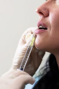 Увеличение губ гиалуроновой кислотой в клинике косметологии Code Beauty Medicine