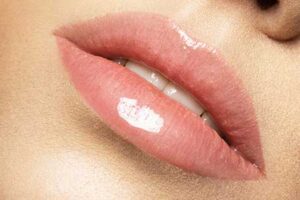 Биоревитализация губ в клинике косметологии Code Beauty Medicine
